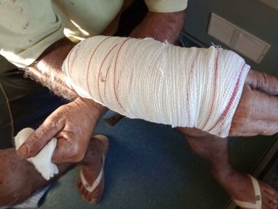 Imagem da notícia Ataque de cachorro Pitbull deixa homem ferido em Chapadão do Sul